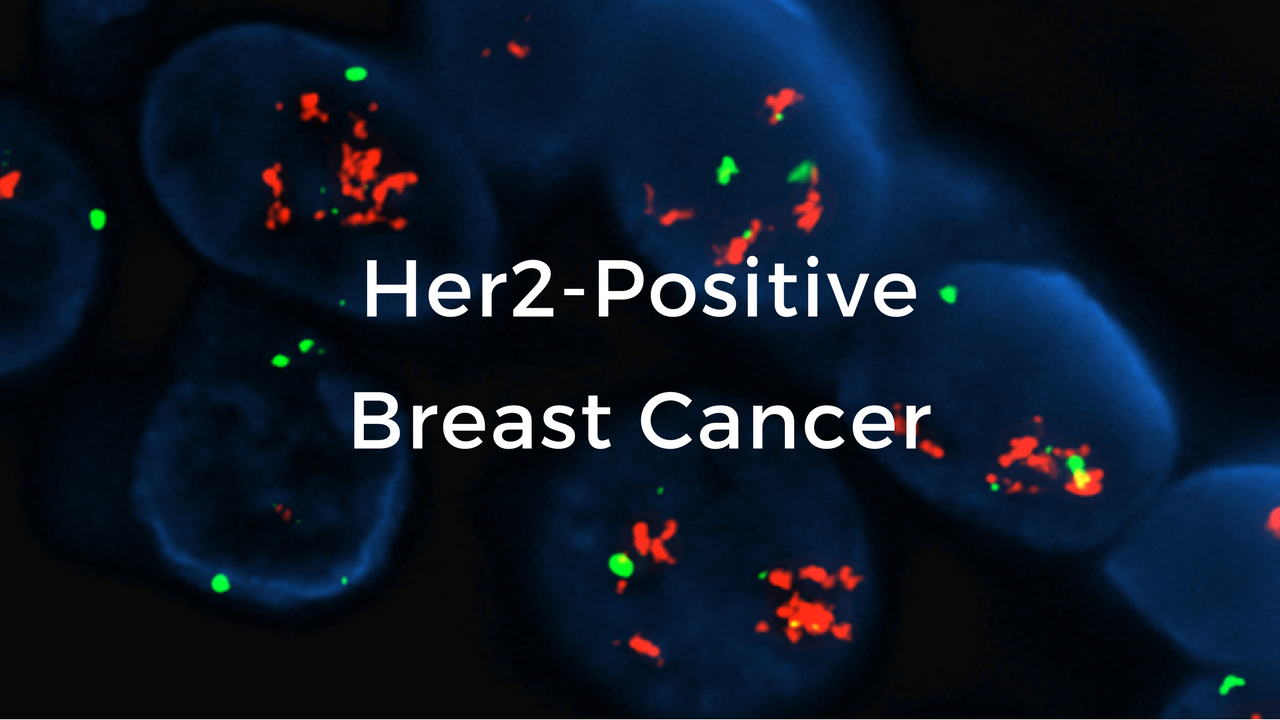 HER2 Positive Breast Cancer: The Breast Cancer School for Patients