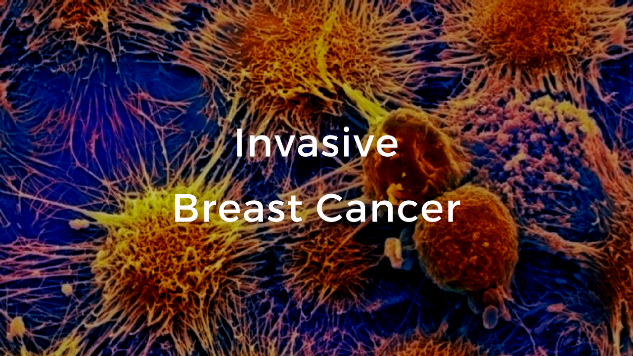 Invasive Breast Cancer: The Breast Cancer School for Patients