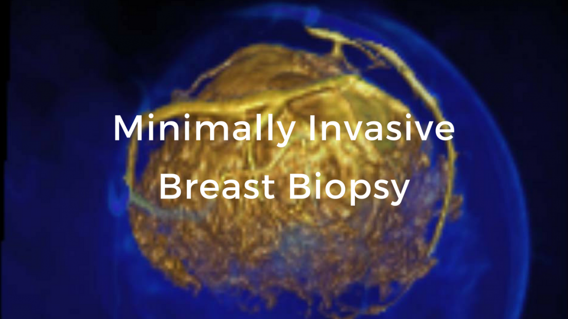 Cutting Edge Advances Video Course: The Breast Cancer School for Patients