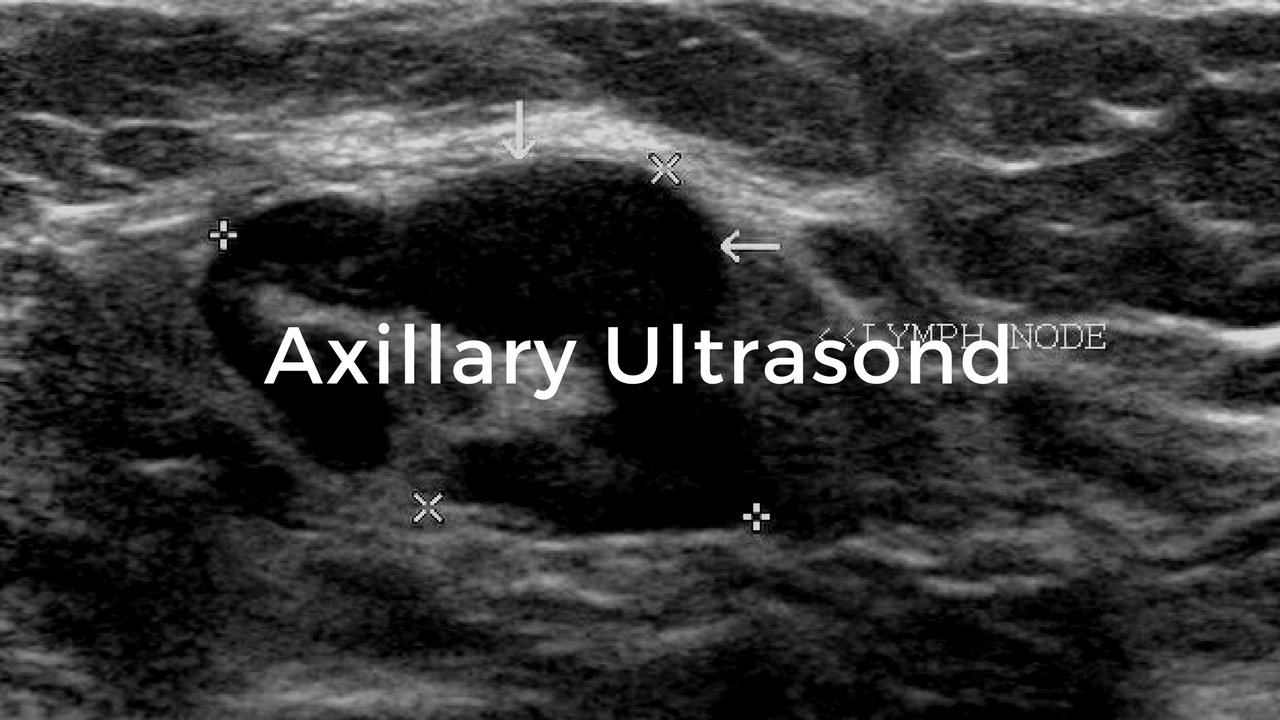 Axillary Ultrasound Breast Cancer School For Patients axillary-ultrasound-breast-cancer-school-for-patients