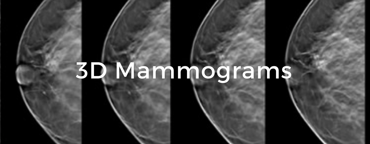 3D Mamograms (Breast Tomosynthesis):Breast Cancer School for Patients